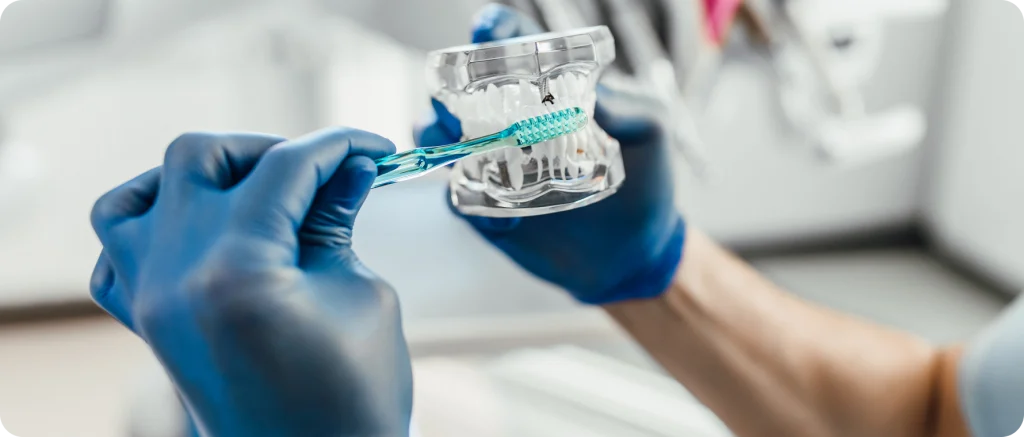 extraction dent ectopique canine