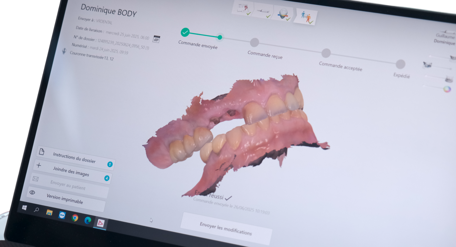 muqueuse buccale lesions persistantes