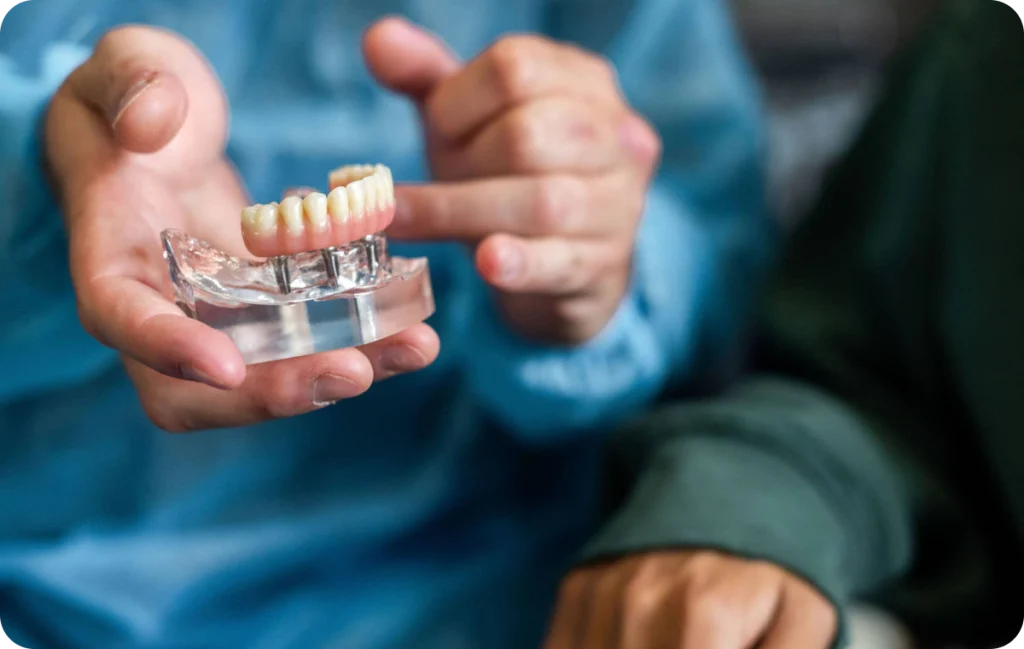 prothese sur implant esthetique