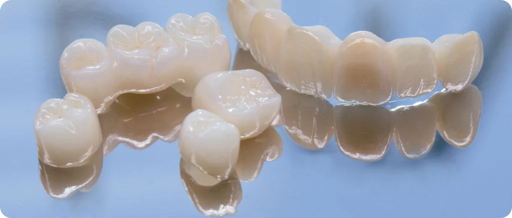 bridge dentaire kaufmann